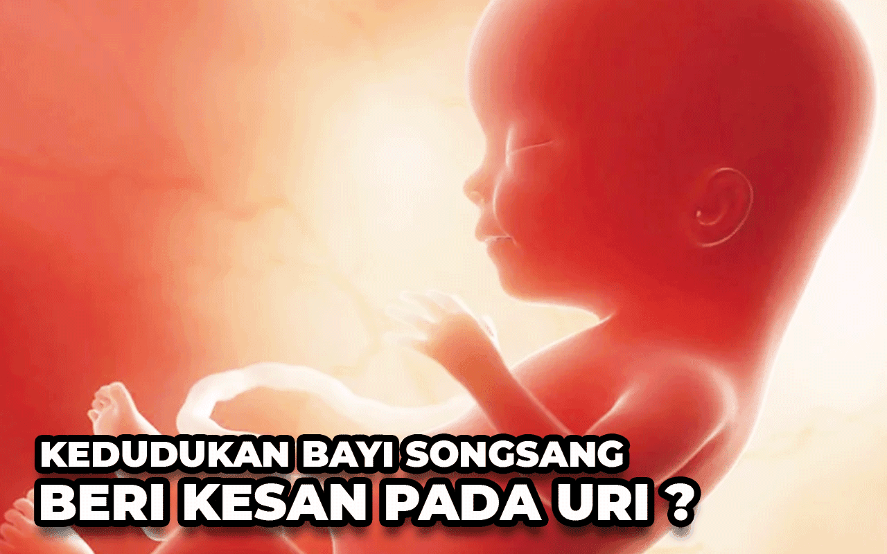 KEDUDUKAN BAYI SONGSANG BERI KESAN PADA URI?